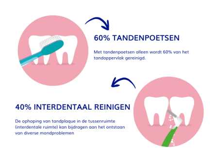 60% tandenpoetsen 40% interdentaal reinigen